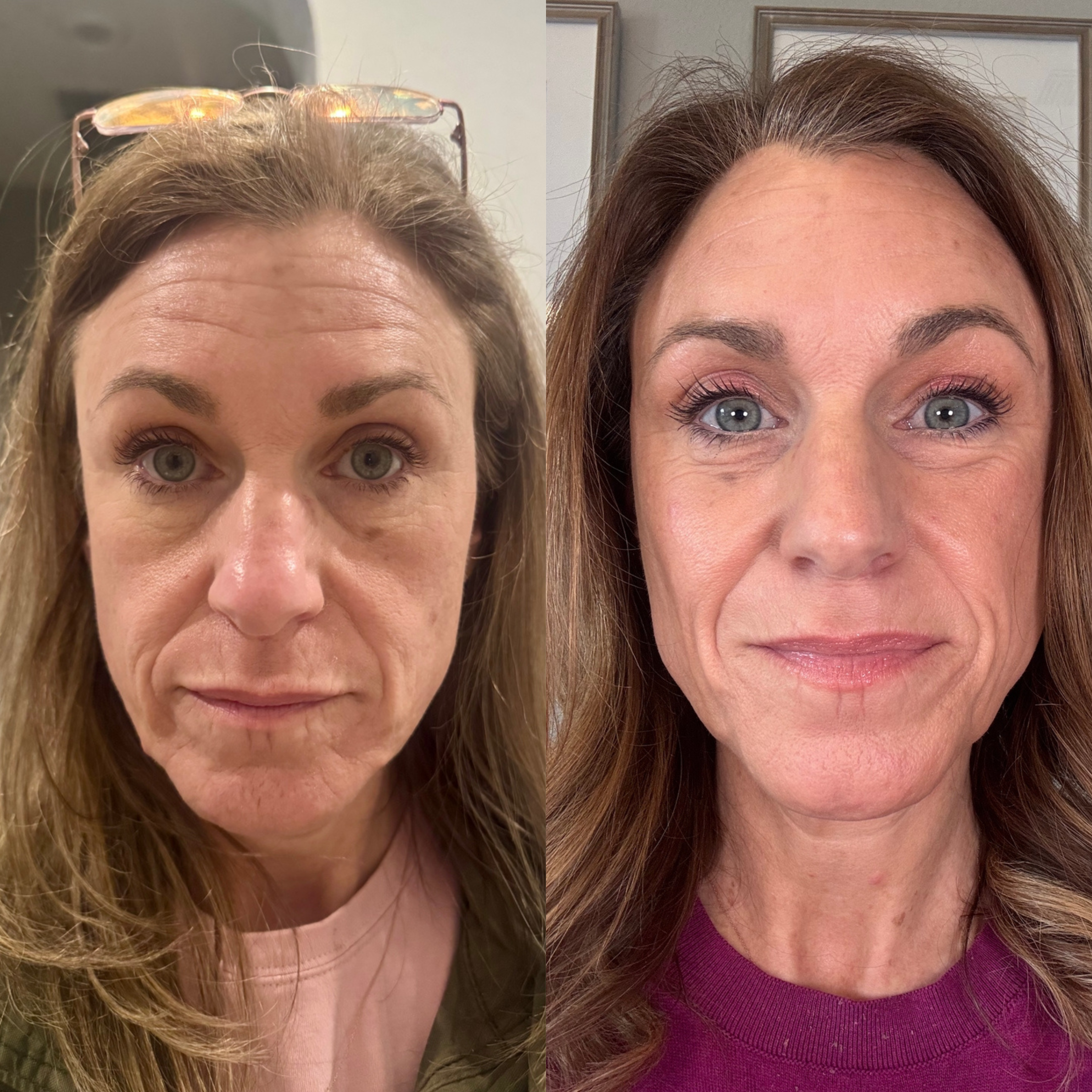 ACTIVE PRO SERUM | ANTI-AGING