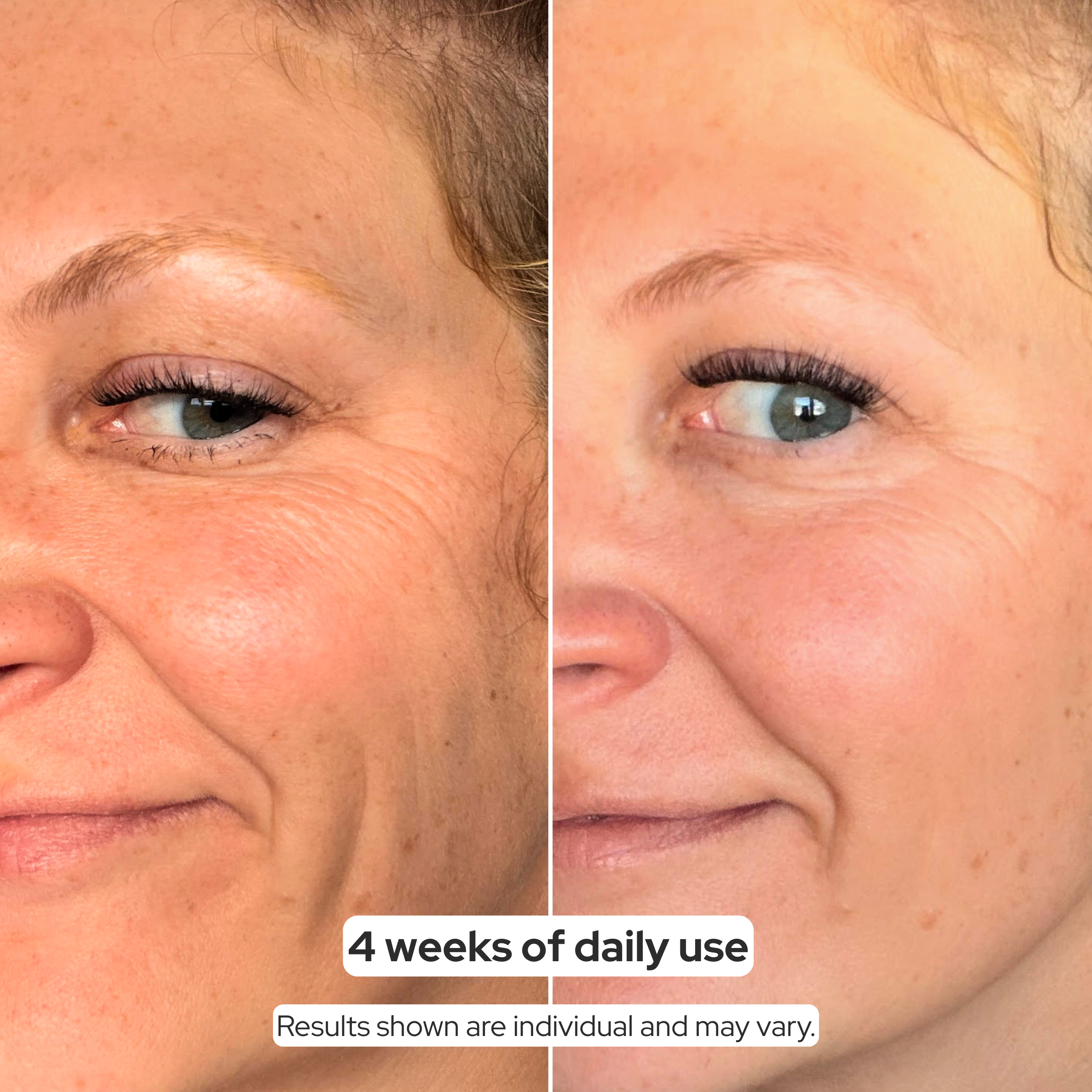 ACTIVE PRO SERUM | ANTI-AGING