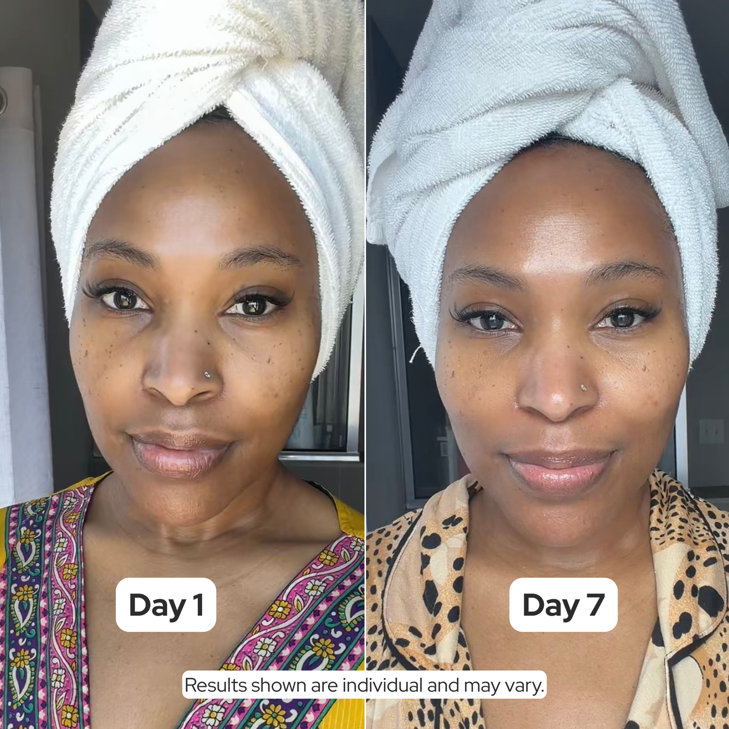 CE SERUM | COMPLEXION BRIGHTENING