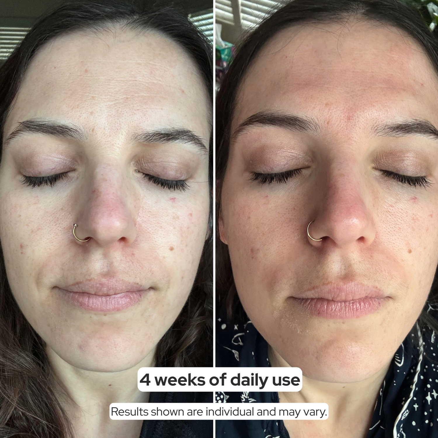 ACTIVE PRO SERUM | ANTI-AGING