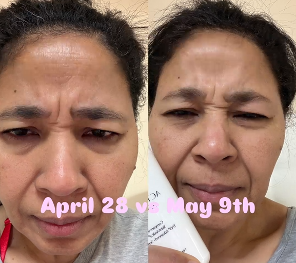 ACTIVE PRO SERUM | ANTI-AGING