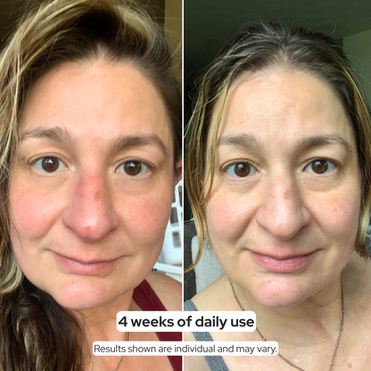 ACTIVE PRO SERUM | ANTI-AGING
