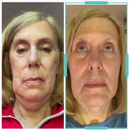 ACTIVE PRO SERUM | ANTI-AGING